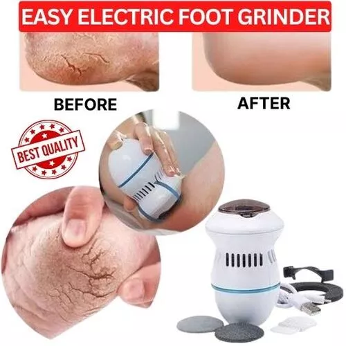 New Electric Foot Grinder Dead Skin Remover TK