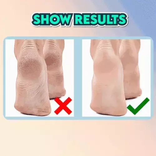 New Electric Foot Grinder Dead Skin Remover