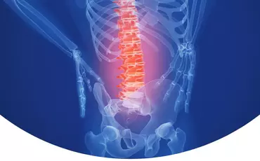 Maux de dos chroniques et surutilisation du dos